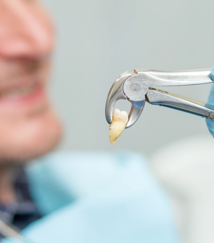Doğala Diş Kliniği — Cerrahi Çekim